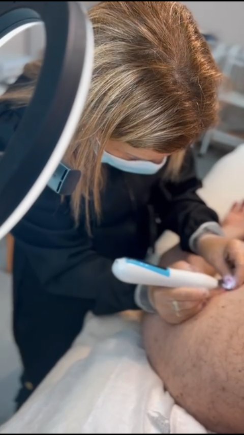 Procedimento de jato de plasma