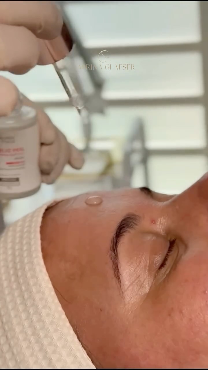 Peeling facial sendo aplicado na Bellitia