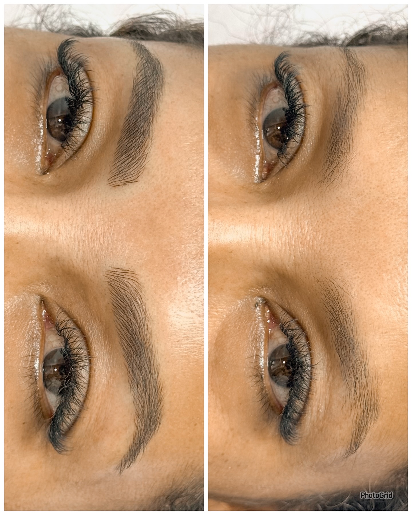 Resultado de nanopigmentação antes e depois